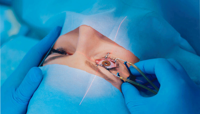 Best Refractive or  LASIK    procedure in Thane by  Dr. Neeta Maske at Icon Vision Clinic.